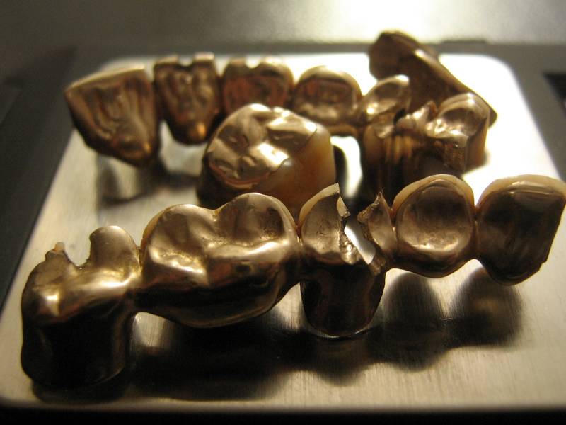 Dental scrap gold close up