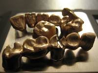 Close up of dental scrap gold